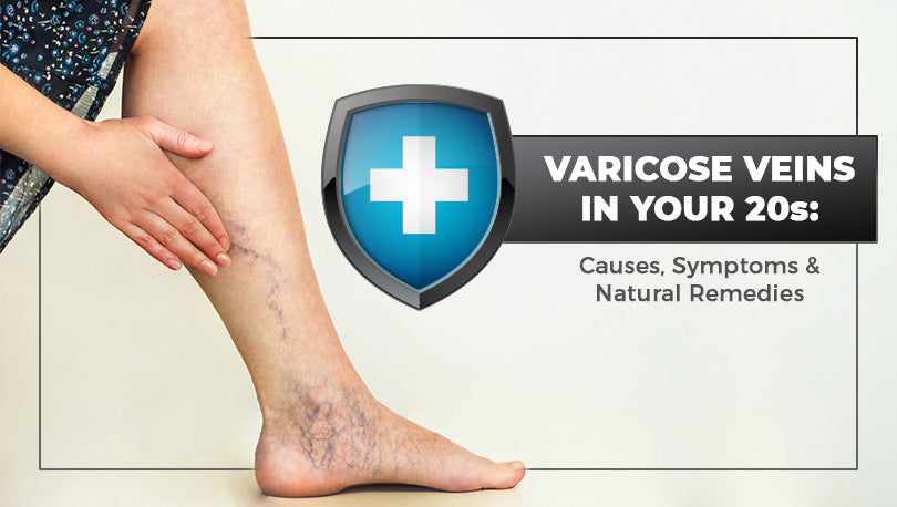 Can You Get Rid of Spider Veins Naturally? 